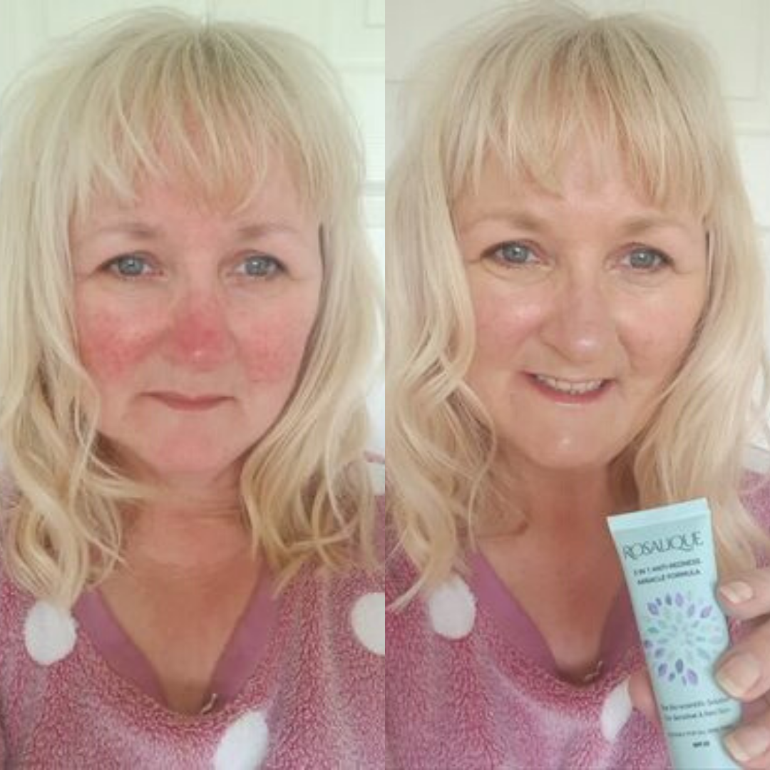 Rosalique Crema 3 in 1 Anti-Rossore Miracle Formula SPF50-30ml